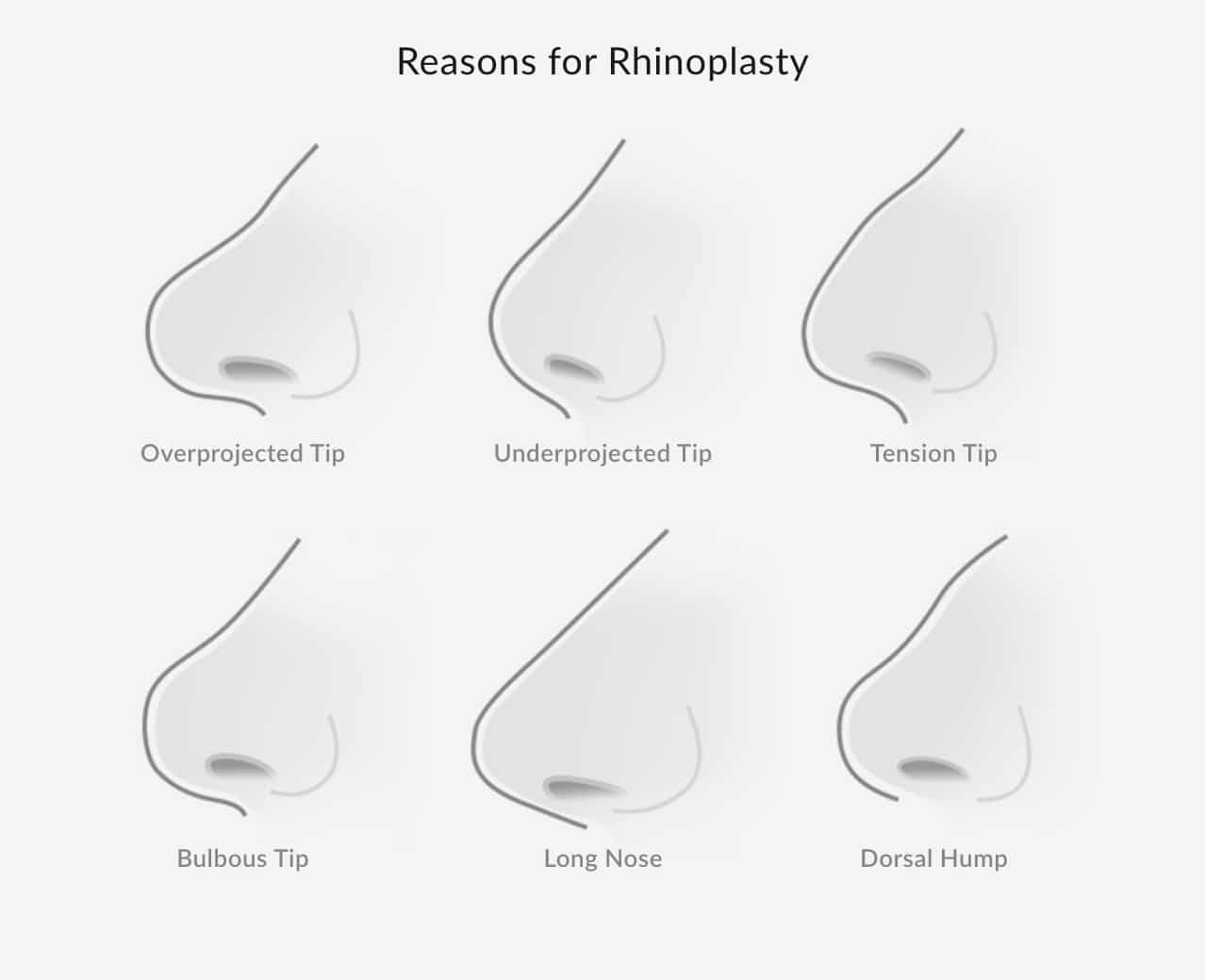 Rhinoplasty Denver CO