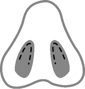 1753895123_closed-rhinoplasty